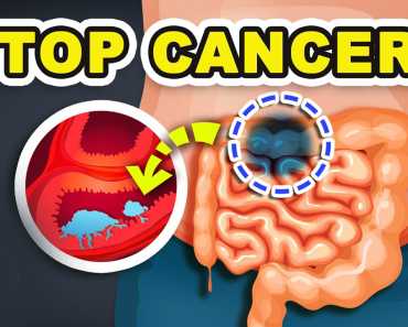 Top 10 Anti-Cancer foods that you need to eat